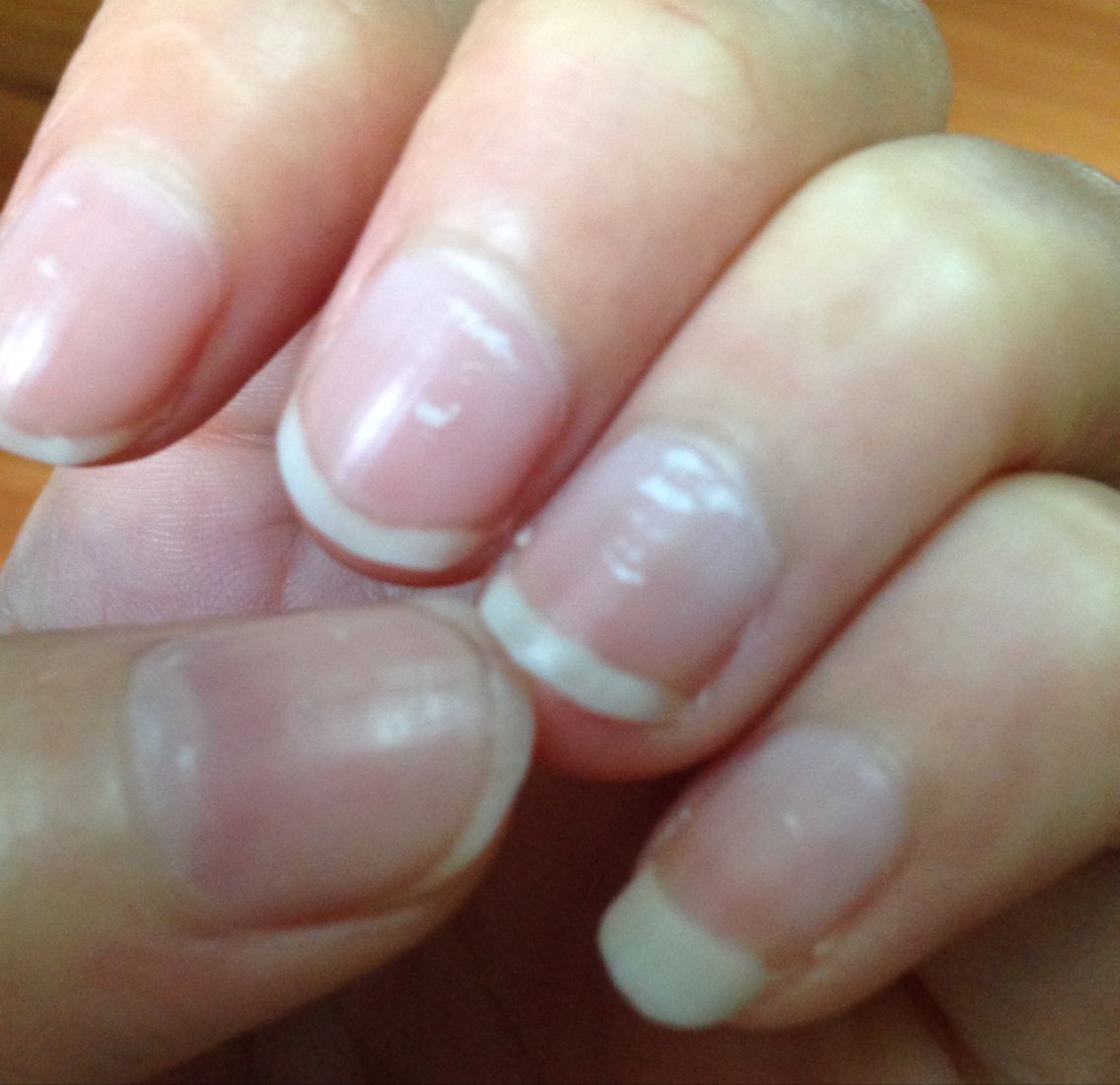 Ten fingernails and no crescent, mean that the body is unhealthy? This is the scientific