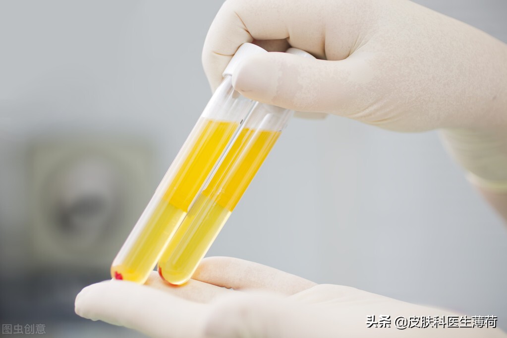 把血抽出來再打到臉上 這是什麼喪心病狂的美容方法 皮膚科醫生薄荷 Mdeditor
