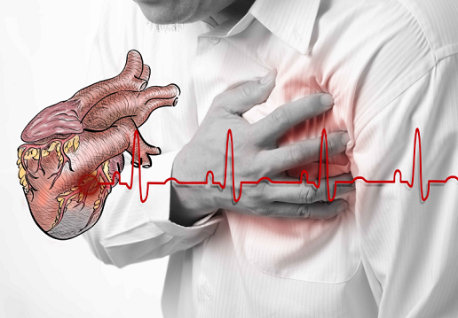 医生：心梗的5大征兆，一定要警觉，早发现或许能救命！