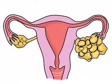 &ldquo;单孔&rdquo;小手术，&ldquo;无痕&rdquo;治疗大囊肿