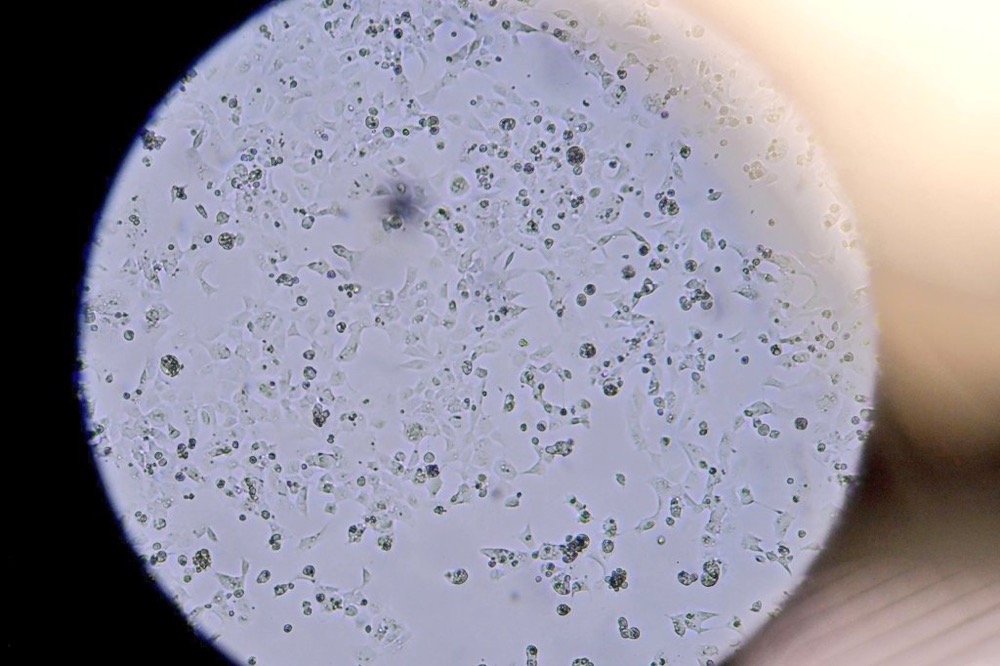 如同恐怖片！英国现变异病毒，首相紧急下令封城，伦敦民众大逃亡