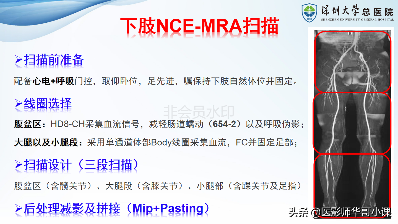 磁共振非增强双下肢血管MRA
