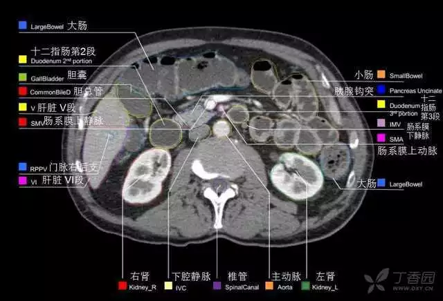 掌握这篇解剖，晋级腹部CT影像诊断高手（精细版）