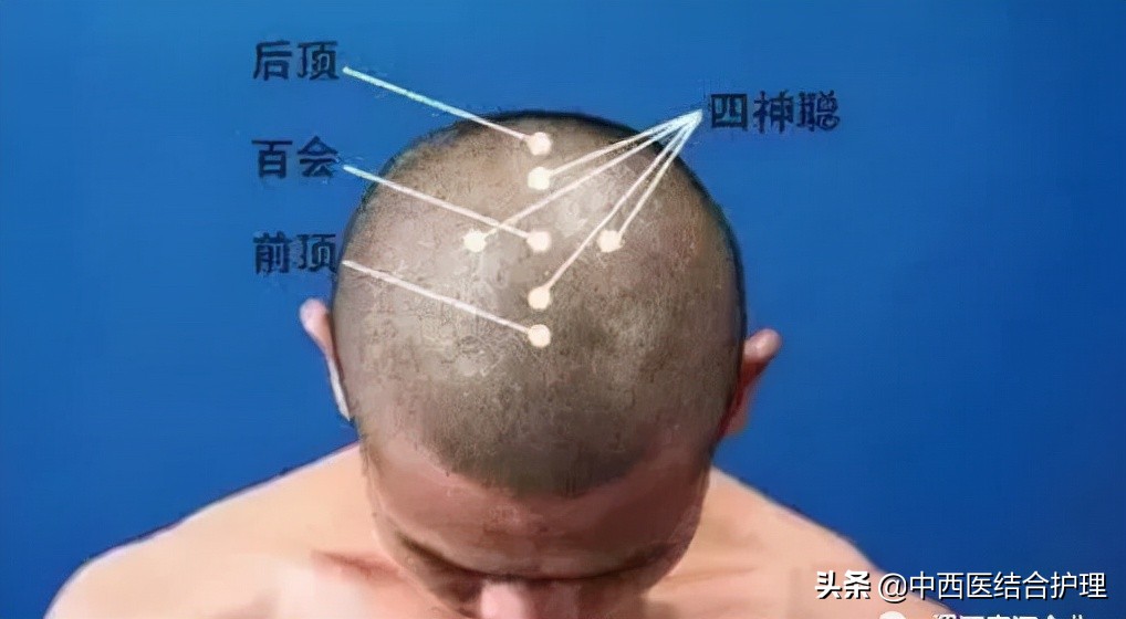 "Acupoint Science Popularization" Baihui is "Heaven", Yongquan is