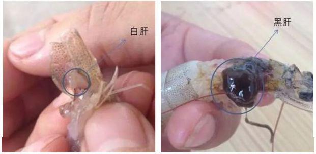 虾肝脏不好出现白便的原因 虾肝脏引起的白便如何治疗