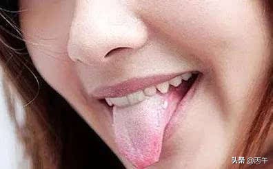 養血就是抗衰老！ 這樣補血堪比美容，快速補氣血l