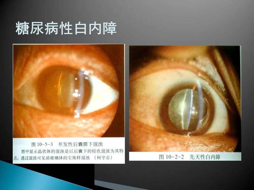 健康科普大赛获奖作品展示⑤|老年人常见眼部不适