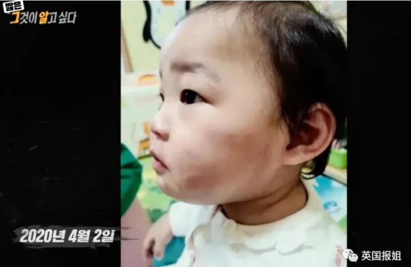 父母虐死1岁女儿，疑似踩到胃破骨碎！20万人为