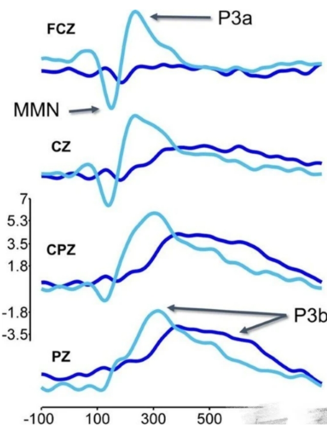 人走後能聽到親人的聲音嗎？如果沒趕上見最後一麵，請不要難過