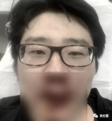 "中国病毒","滚出这里"!37岁中国