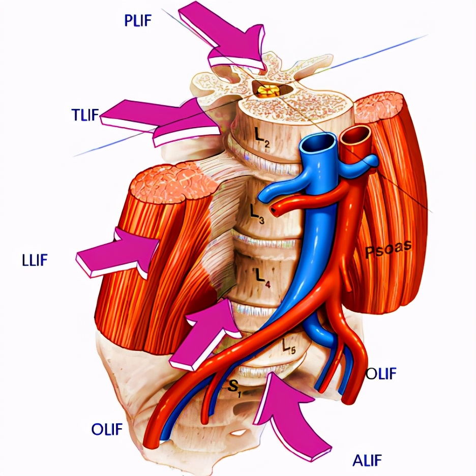 腰椎血管分布图图片