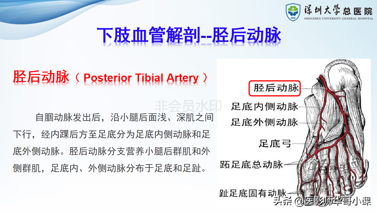 磁共振非增强双下肢血管MRA
