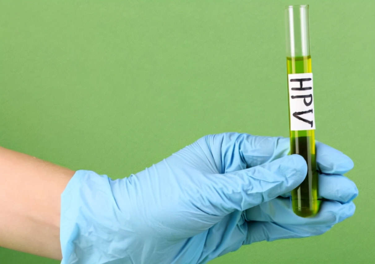 If you have HPV in your body, just look at it. People with HPV