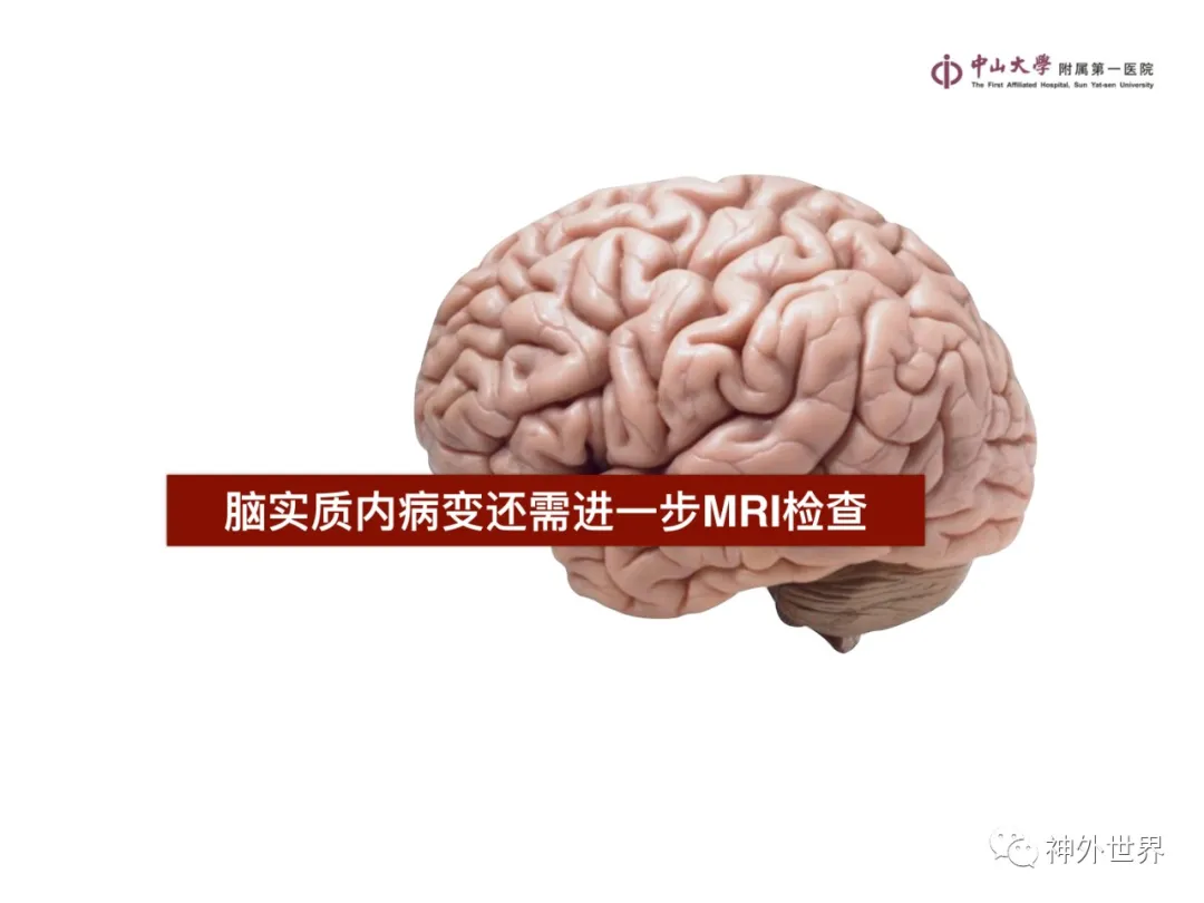 最全影像总结 | 颅内病变 MR、CT 的阅片技巧，太赞了