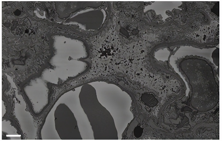 The magical micro world presented under the electron microscope - iNEWS