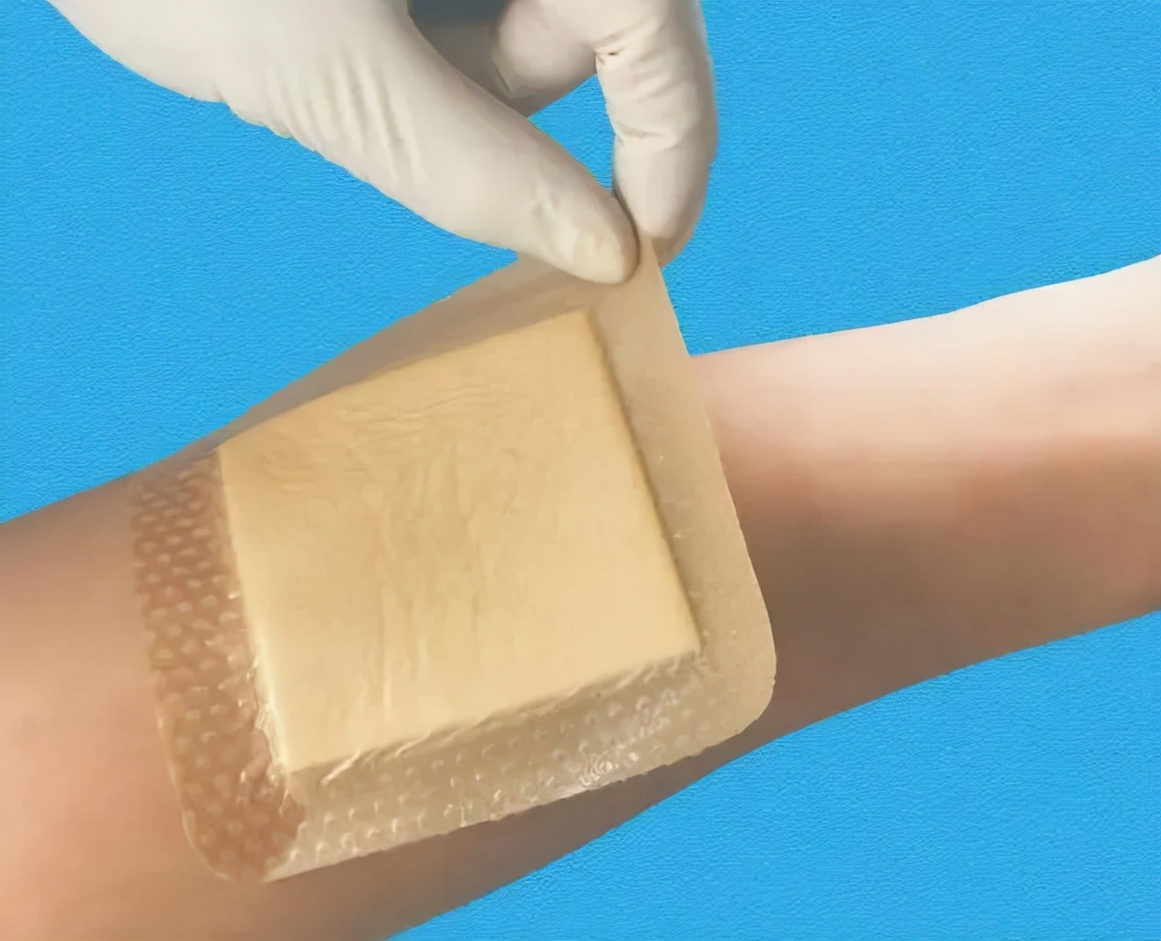 Foam dressing and wound management iMedia