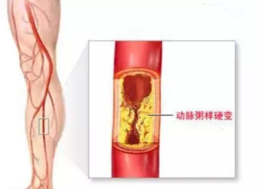 什么症状可以看血管外科