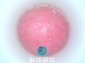 深层清洁黑头，边吸边看的inFace可视化黑头仪