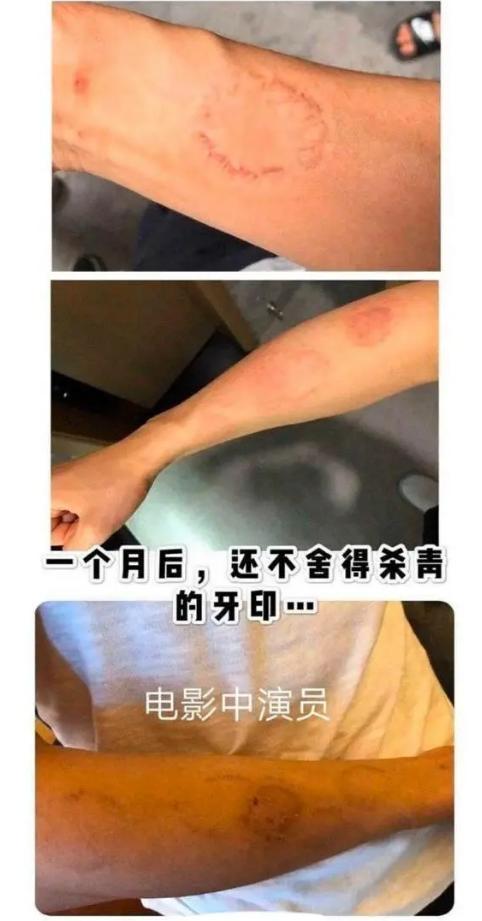《少年的你》周冬雨私下太社会？劝未成年人喝酒，咬伤剧组演员