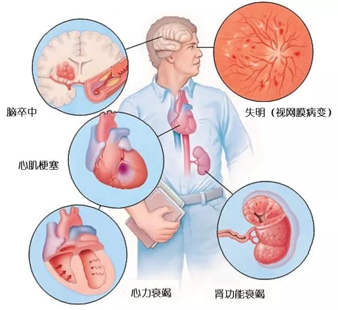 降压药会成瘾？这背后是一种对医药的典型误解