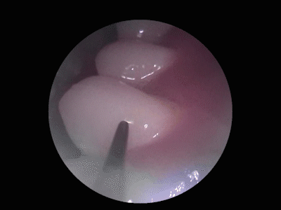 500W像素高精内窥镜，素诺可视洁牙仪的可玩性很高