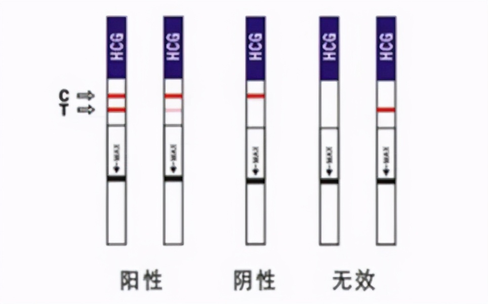 什么情况可能会出现意外怀孕，意外怀孕的正确处理方式