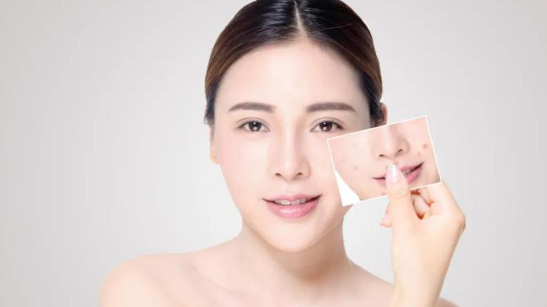 What exactly is quot micro ecological skin care quot ?Why are the big name skin