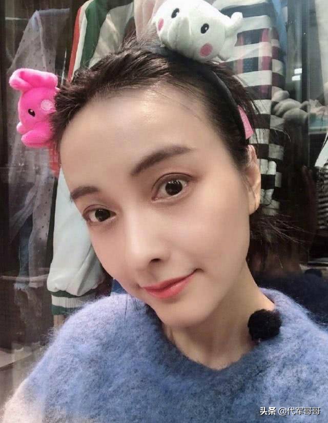 饱受脱发困扰的美女明星，郑爽第八，杨幂第二，鞠婧祎排第几？