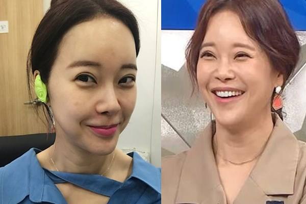 韩国“江南美人”千千万，但“换头”成功，逆袭成女神的只有她们