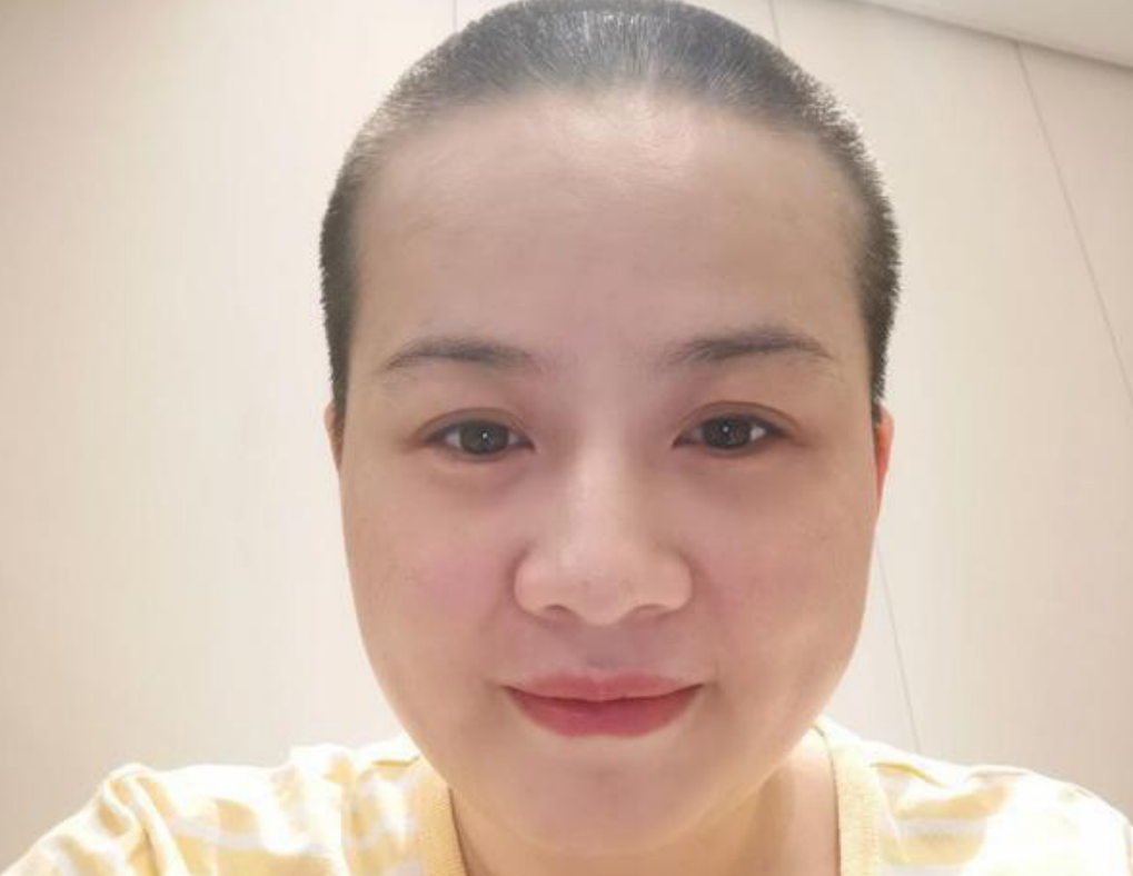 岳云鹏妻子剃光头了？在医院自拍发文要蓄发，身体出现问题了？