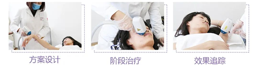 女生怎样脱毛最合适？