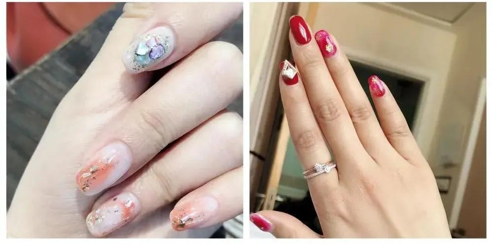 父母双双患癌后,28岁名校金融女也被查出癌症晚