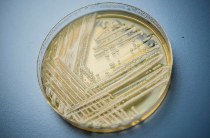 美國出現“超級真菌”疫情，已有多人被感染，感染者無法治愈
