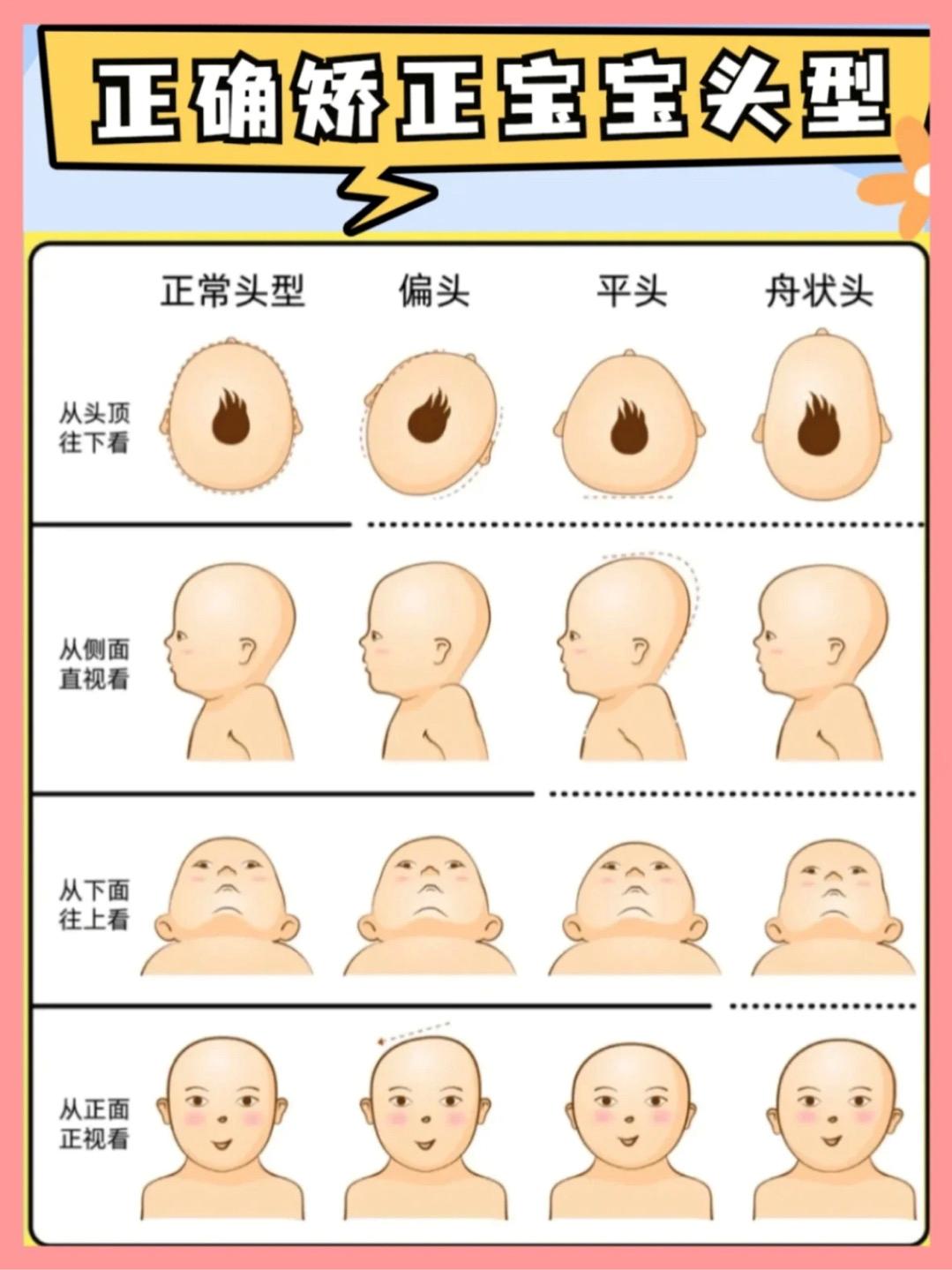 How to correct the baby's head shape?These five methods teach you how