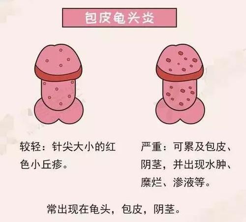 最近丁丁老癢癢的是怎麼回事？
