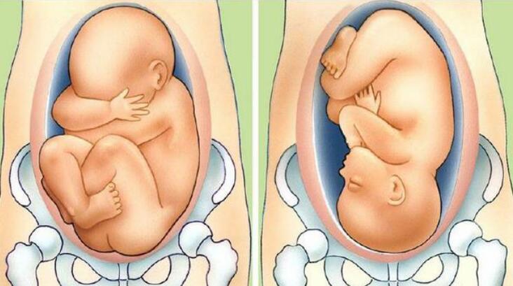 胎儿胎位什么时候才能固定？如果不正常，又该怎么办呢？