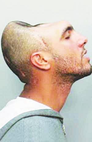 原本只是涉嫌教唆卖淫，却因具有独特生理特征而红遍全球