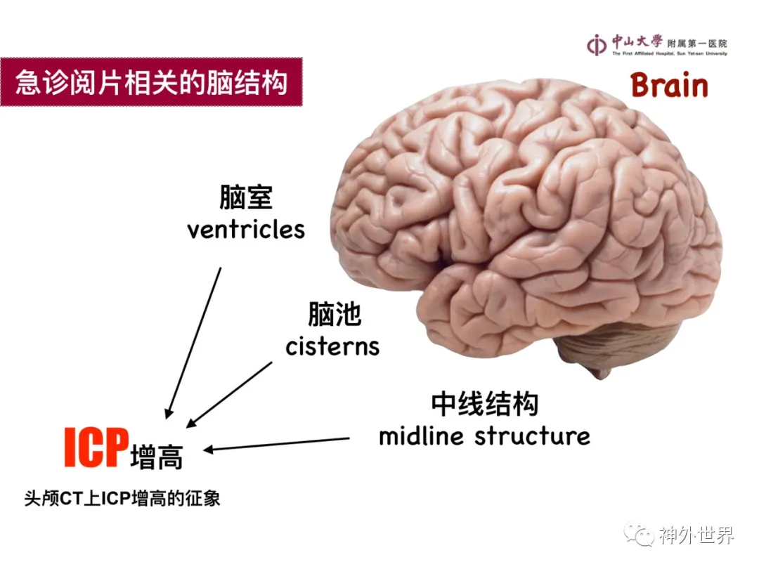 最全影像总结 | 颅内病变 MR、CT 的阅片技巧，太赞了