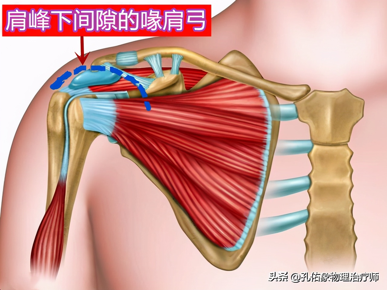 出现肩膀疼痛、活动困难就是肩周炎吗？医生辟谣，带您了解肩痛