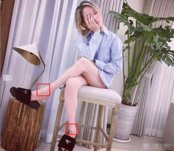 41岁萧亚轩疑添新伤！晒照膝盖大片红肿淤青，刚被狗咬伤还未痊愈