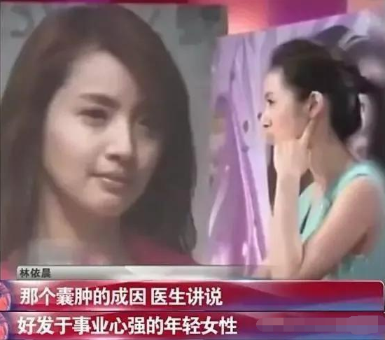 “傻白甜”林依晨的惨淡豪门路，她的故事远比你想象的更恶劣