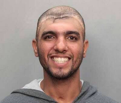 原本只是涉嫌教唆卖淫，却因具有独特生理特征而红遍全球