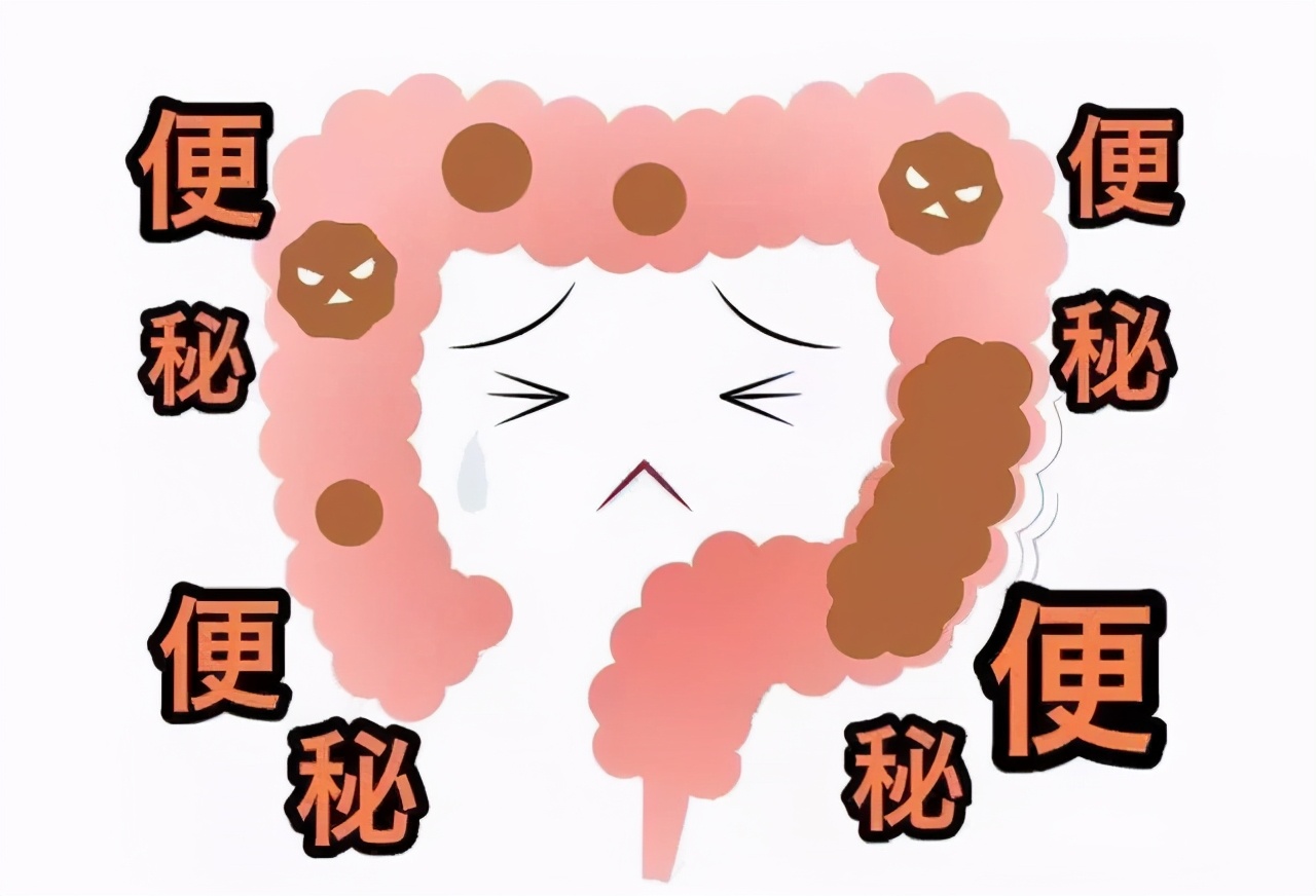 便秘怎么办快速排便？分享四种简单改善便秘的方法