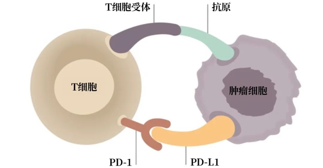 全球首例：新生兒吸入母親的宮頸癌細胞，導(dǎo)致肺癌