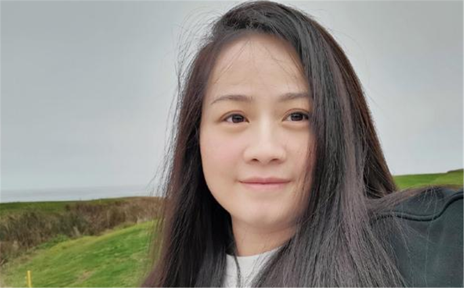 郑敏高情商化解岳云鹏危机，现剃光头住院，岳