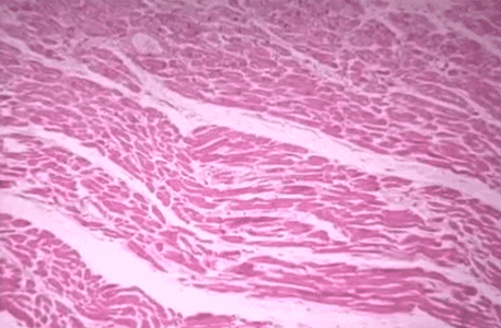 日本嚴重核泄漏事件，被輻射人83天身體腐爛去世