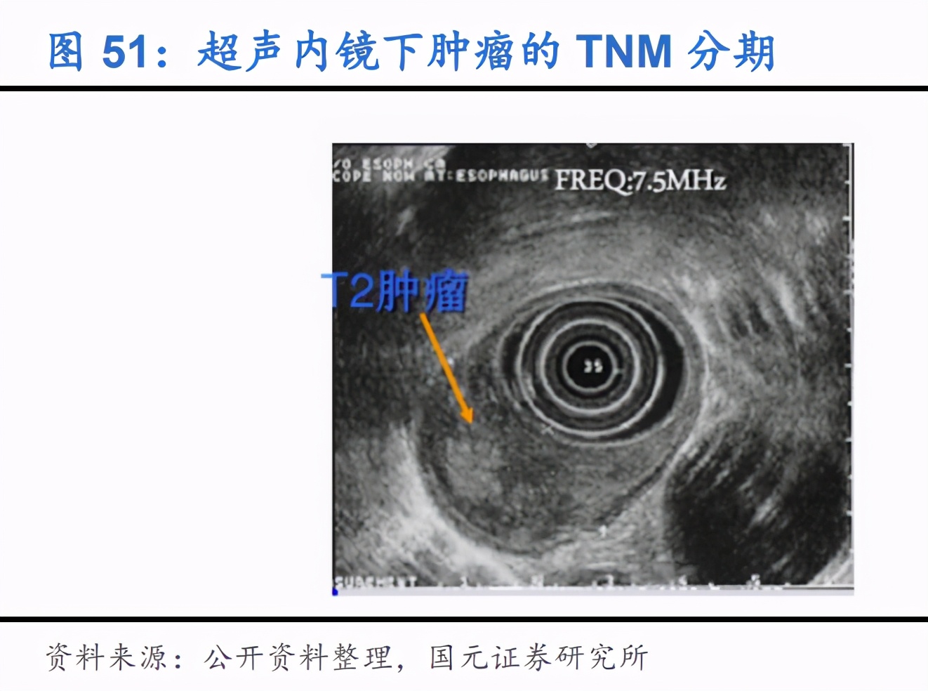 内窥镜行业深度报告：优选国产替代快车道，把握细分领域龙头