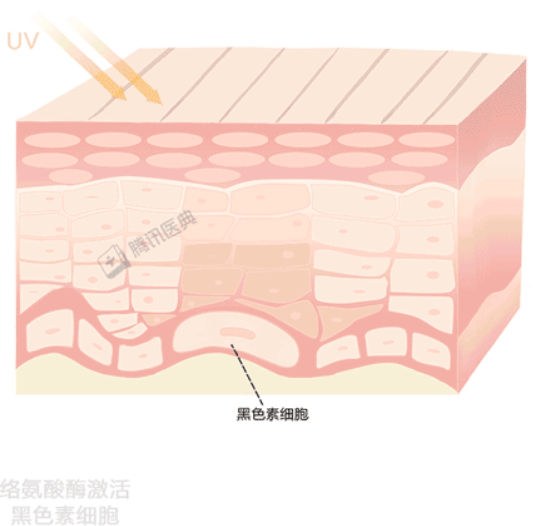 曬黑後白不回來？ 可能是你沒做這8件事