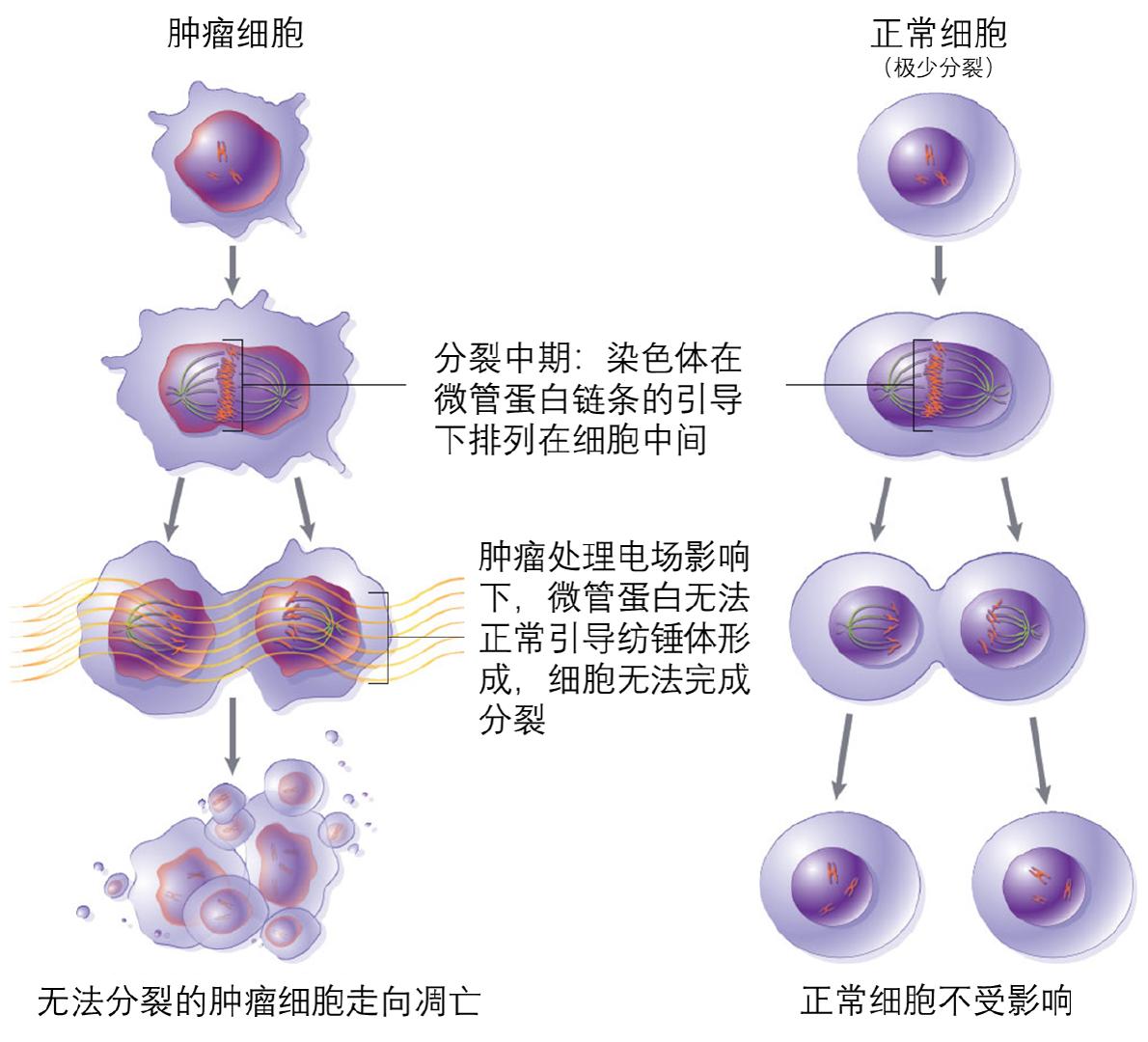 24hour nonstop anticancer electric field therapy that is expected to cancer is here