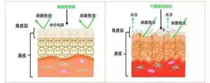 逃不过换季皮肤和鼻子易过敏？4大缓解对策拯救你